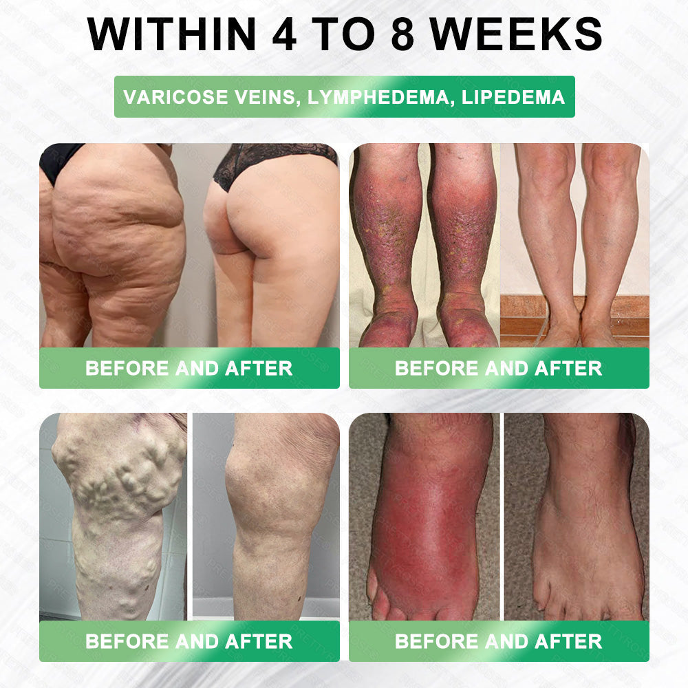 ⏰Congratulations! You’ve unlocked an exclusive 𝑷𝒓𝒆𝒕𝒕𝒚𝒓𝒐𝒔𝒆® offer! An extra30% 𝑂𝐹𝐹 has been applied just for you today! Click below to claim it now — 𝗍𝗁𝗂𝗌 𝗌𝗉𝖾𝖼𝗂𝖺𝗅 𝖽𝖾𝖺𝗅 𝗐𝗈𝗇’𝗍 𝗅𝖺𝗌𝗍 𝗅𝗈𝗇𝗀! ⏰